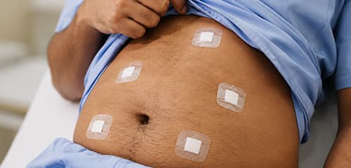 Post-biliary surgery rehabilitation care
