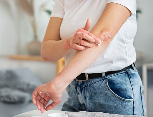 Skin Allergy & Rash Care